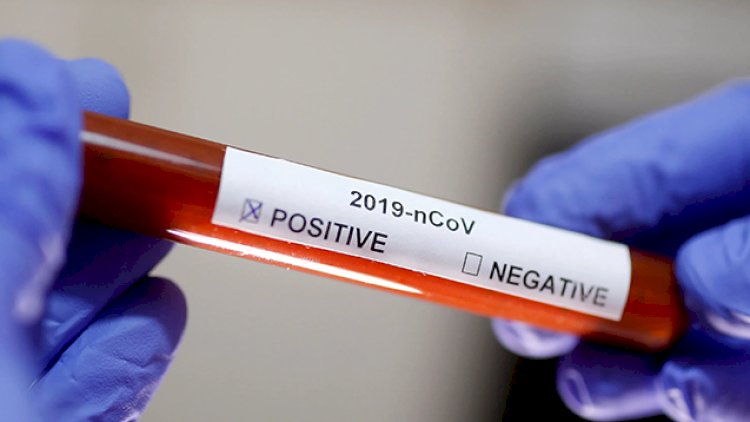    Azərbaycanda daha 49 nəfərdə koronavirus aşkarlandı -   1 nəfər vəfat etdi