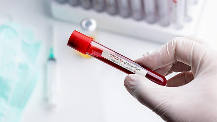    Azərbaycanda daha 30 nəfərdə koronavirus aşkarlandı -   2 nəfər vəfat etdi