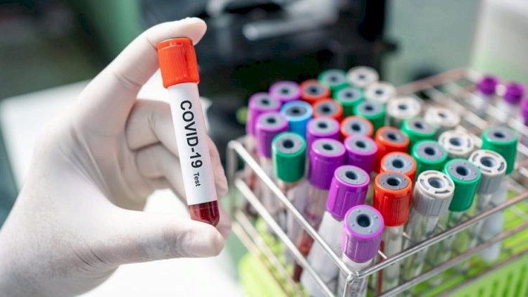    Koronavirus ispanlara göz açmağa imkan vermir   – Daha 430 ölü