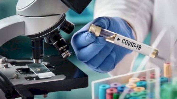    Daha bir məşhur koronavirusdan öldü   