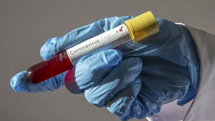    Azərbaycanda daha 38 nəfərdə koronavirus aşkarlandı -   42 nəfər sağaldı
