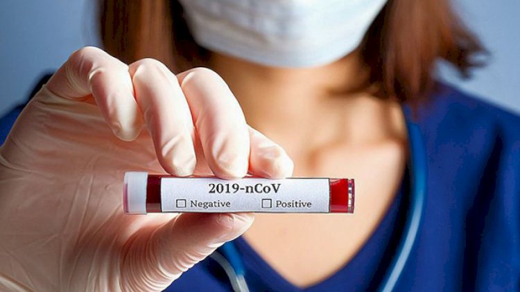    Koronavirus dünyanı təmizləyir   