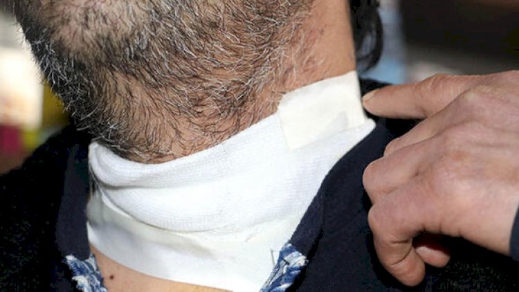    “20 Yanvar“da 43 yaşlı kişi boğazını kəsdi   