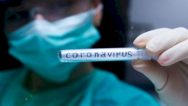    22 yaşlı azərbaycanlı koronavirusdan öldü   