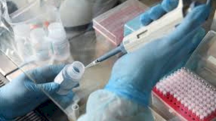    Koronavirus Tacikistana da “ayaq açdı”   - 15 yoluxma