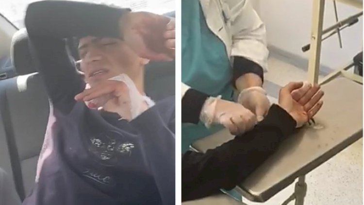    Azərbaycanda yol polisləri barmağı qopan şəxsi xəstəxanaya belə çatdırdı - Video   