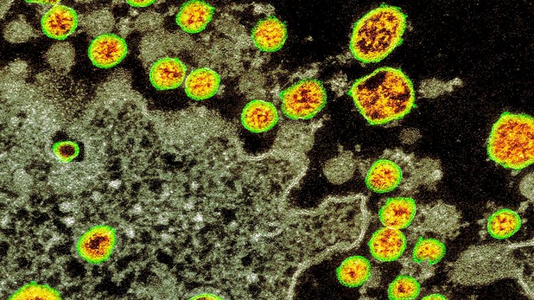    Dünyada koronavirus dezinformasiyaları...   