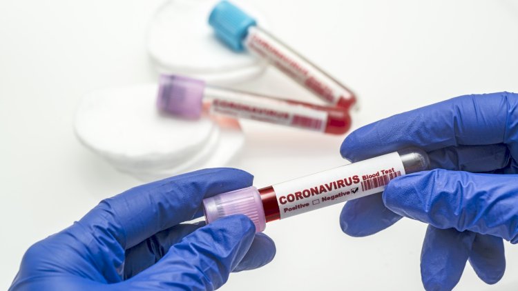    Azərbaycanda daha bir yenilik - Koronavirus testi neqativ çıxanlara...   