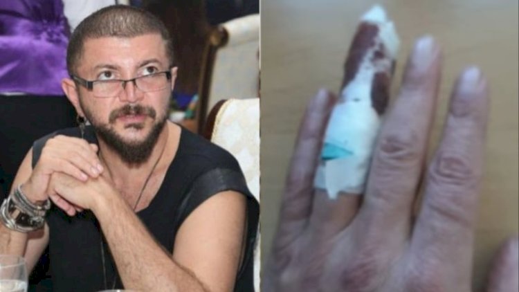    Aygün Kazımovanın qonağı olmaq Rəhimə düşmədi   – Barmağı qopdu