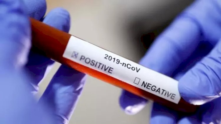    Azərbaycanda daha 262 nəfərdə koronavirus aşkarlandı -   2 nəfər öldü