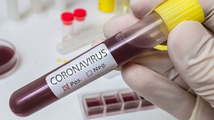    Azərbaycanda daha 75 nəfərdə koronavirus aşkarlandı   