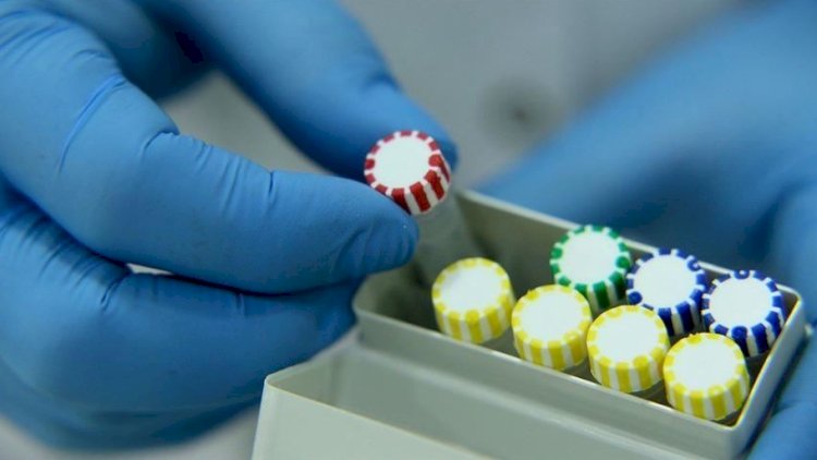    Daha 65 nəfərdə koronavirus aşkarlandı -   2 nəfər vəfat etdi
