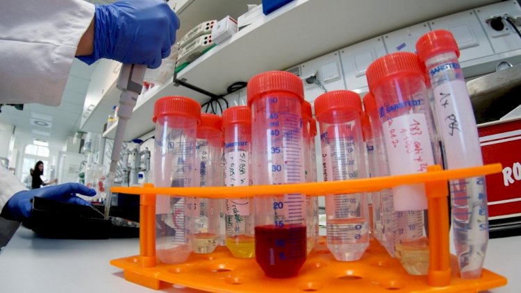    Azərbaycanda testlərin aparılması üçün 24 laboratoriya fəaliyyət göstərir   