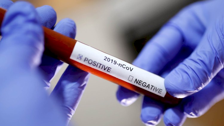    Naxçıvanda indiyədək neçə nəfərdə koronavirus aşkarlanıb?   