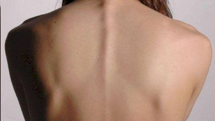    Oksana xəstəlikdən əziyyət çəkir   – Özü açıqladı