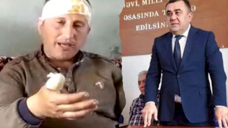   İcra başçısının müavini şikayətçini döyüb pəncərədən aşağı atdı – Azərbaycanda ŞOK   
