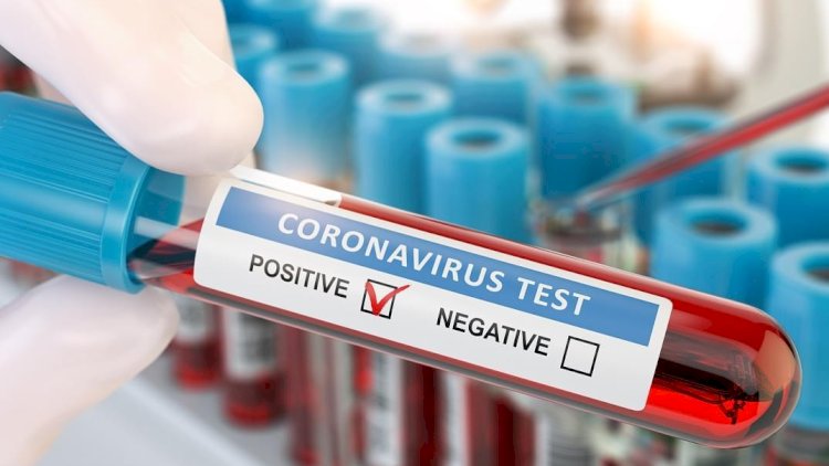    Azərbaycanda daha 113 nəfərdə koronavirus aşkarlandı -   2 nəfər öldü