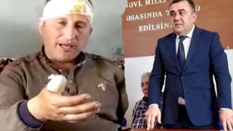    Goranboyda “döyülən“ şəxs sakinlərin torpaqlarını zəbt edibmiş... - Video   