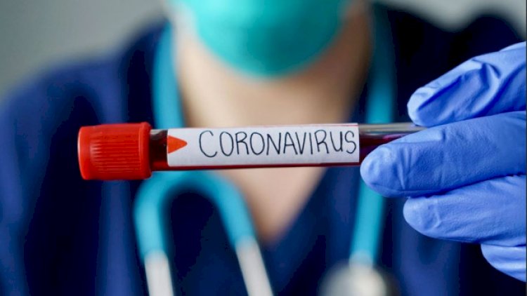    Azərbaycanda koronavirusa rekord yoluxma - 2 ölü   