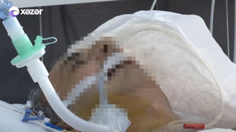    Azərbaycanda koronaviruslu xəstələrin dəhşətli görüntüsü - Video   