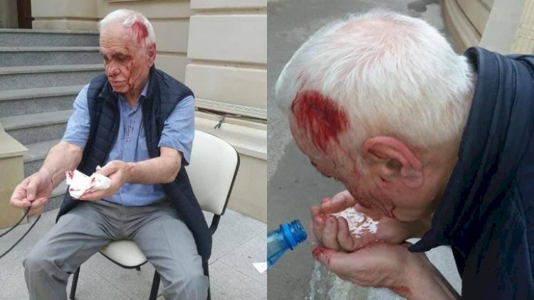    Azərbaycanda keçmiş naziri küçədə döydülər –   Fotolar