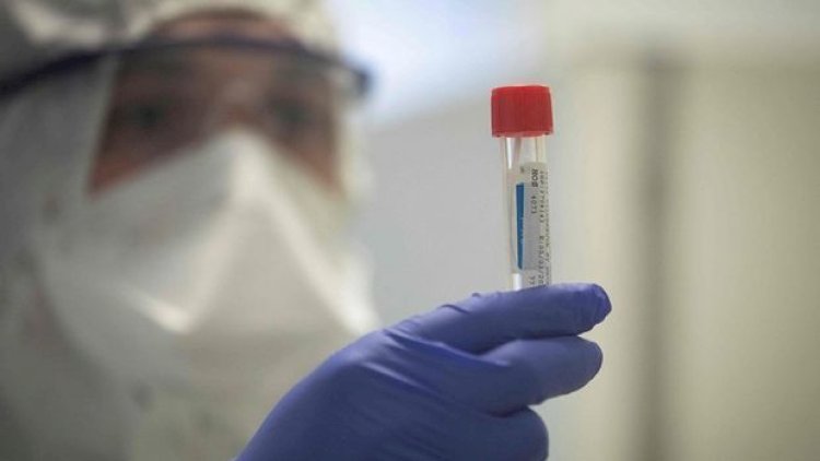    AzTV-də daha bir neçə nəfərdə koronavirus aşkarlandı   