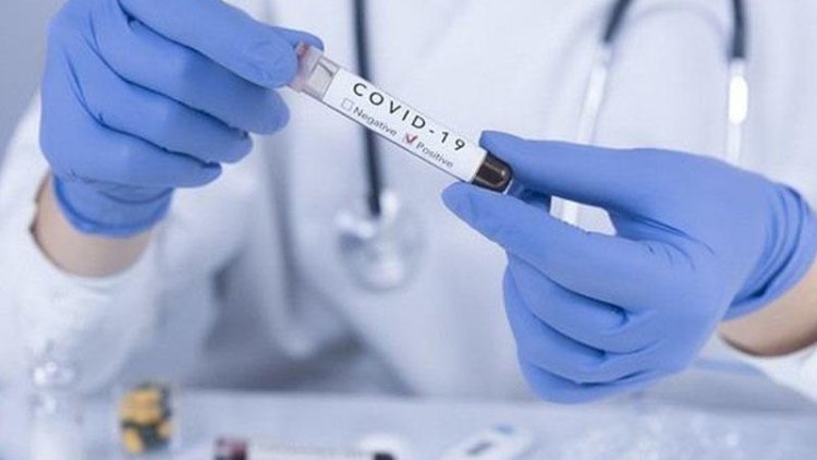    Azərbaycanda rekord sayda koronavirusa yoluxma,   6 nəfər öldü - RƏSMİ