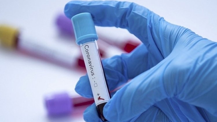    Koronavirus mənfi 20 dərəcədə 20 il yaşaya bilər    