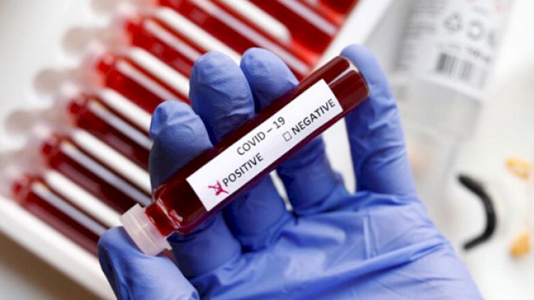    Azərbaycanda daha 556 nəfərdə koronavirus aşkarlandı -   7 nəfər öldü