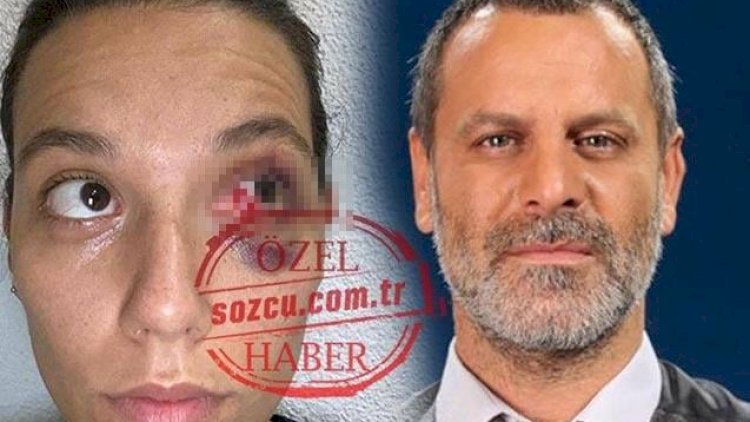    Məşhur aktyor sevgilisini döydü, telefonunu əlindən aldı - Foto   