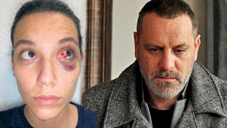    Sevgilisini döyən aktyor peşman olub   – “Kədərliyəm”