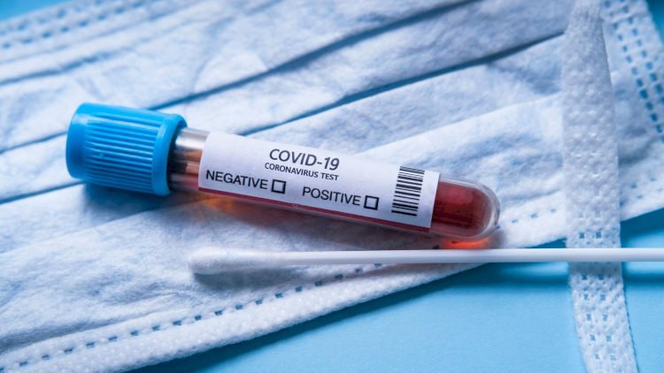    Daha 513 nəfərdə koronavirus aşkarlandı,   8 nəfər vəfat etdi