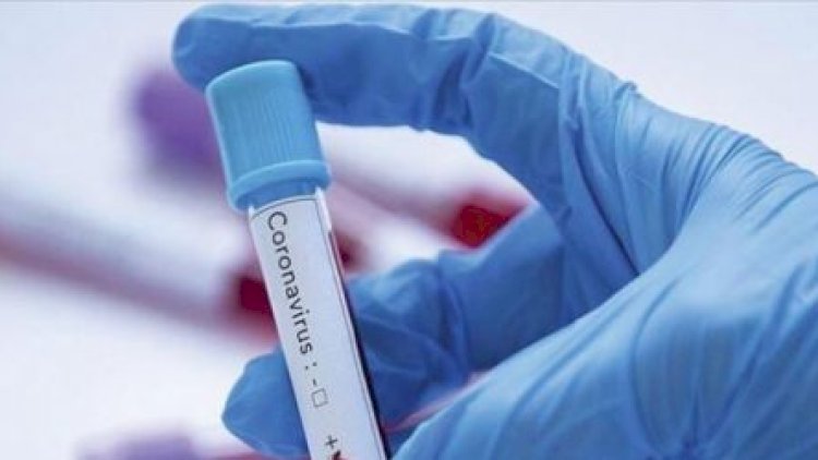    Azərbaycanın bu bölgəsində koronavirus bitdi   