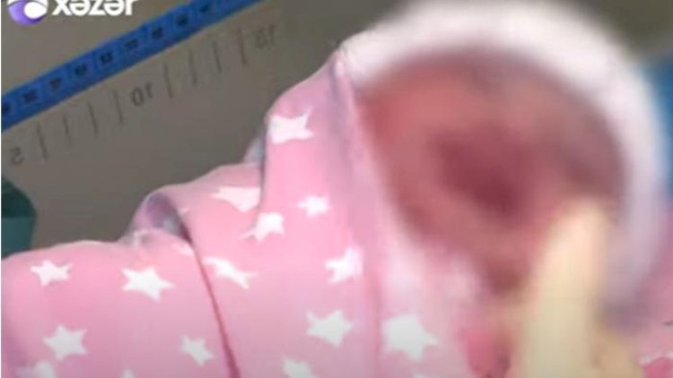    Şəhid gizir Yaşar Babayevin yeni doğulan qızı - Video   