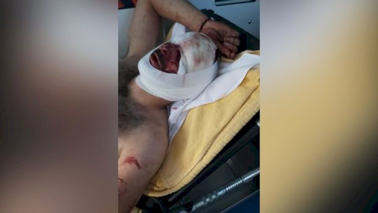    Belçikada ermənilərdən azərbaycanlıya qarşı vəhşilik   - VİDEO/18+