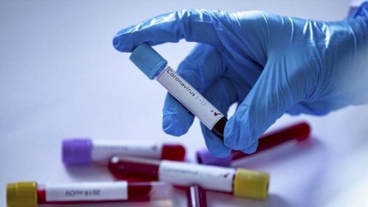    Koronavirusla bağlı son   STATİSTİKA
