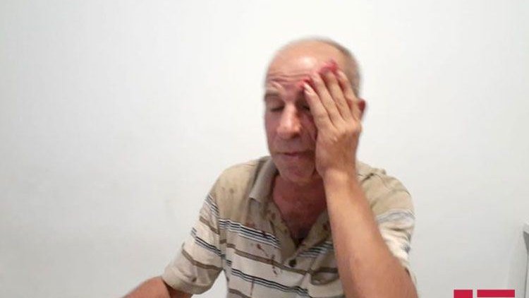    Xalq artistinin qardaşın döydülər - FOTO   