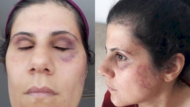    “Ərim, onun rəsmi həyat yoldaşı və 8 uşağıyla bir evdə yaşayıram”   - Türkiyədə ərdə olan azərbaycanlı qadın