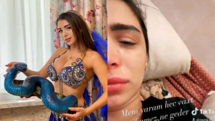    Rəqqasə Rəna tanınmaz halda - Foto    