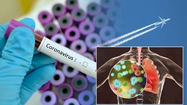    Rusiyada koronavirus qurbanlarının sayı 20 minə yaxınlaşır   