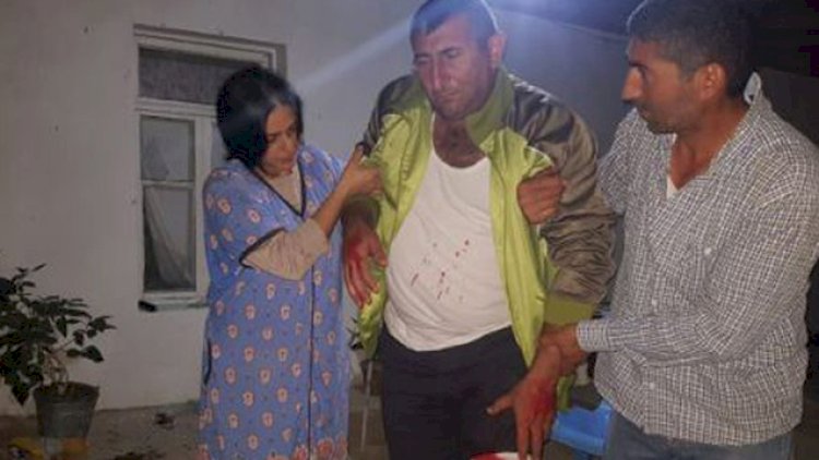    Ermənilərin yaraladığı mülki vətəndaşımızın   FOTOSU