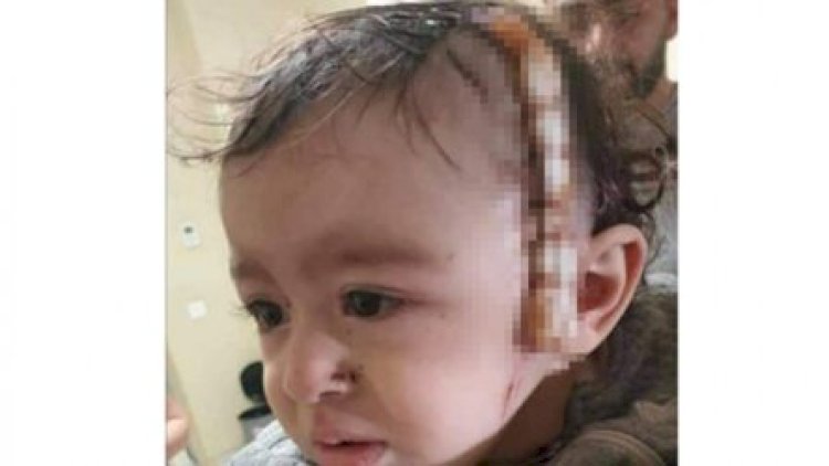    Prezidentin köməkçisi ermənilərin yaraladığı 10 aylıq Zəhranın fotosunu paylaşdı   