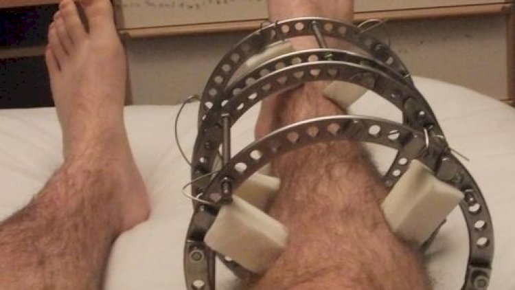   Azərbaycana yeni tibbi cihazlar gətirilib   