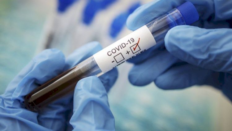    Virus Ermənistanı cənginə alıb:   6 ölü, 745 yeni yoluxma