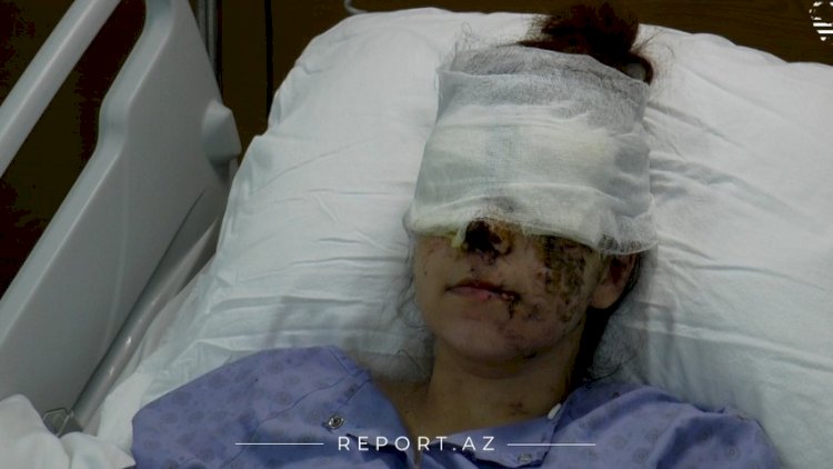    Ermənilərin Gəncə terroru nəticəsində  iki uşaq anası görmə qabiliyyətini itirdi   