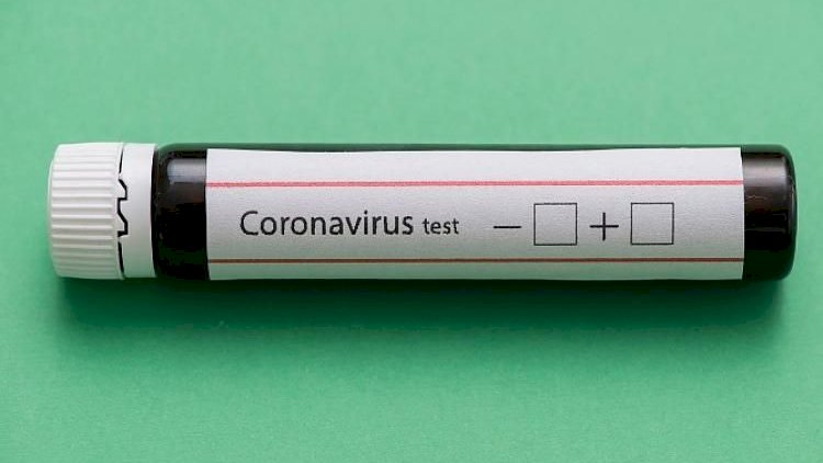    Koronavirusa ən çox hansı yaşda insanlar yoluxur? - Həkimdən   AÇIQLAMA