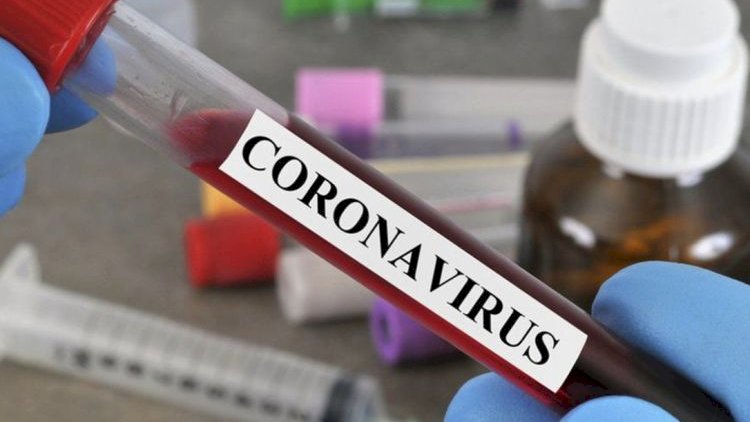    Dünyada koronavirusa yoluxanların sayı 50 milyona çatır   