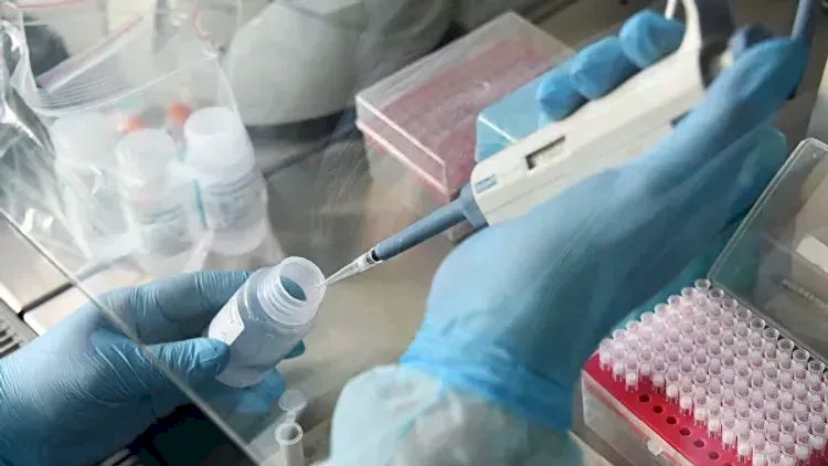    Rusiyada koronavirusdan daha  461 nəfər öldü   