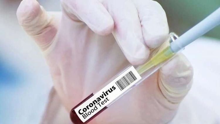    Sərbəst güləş üzrə Azərbaycan millisinin bir neçə üzvü koronavirusa yoluxdu   