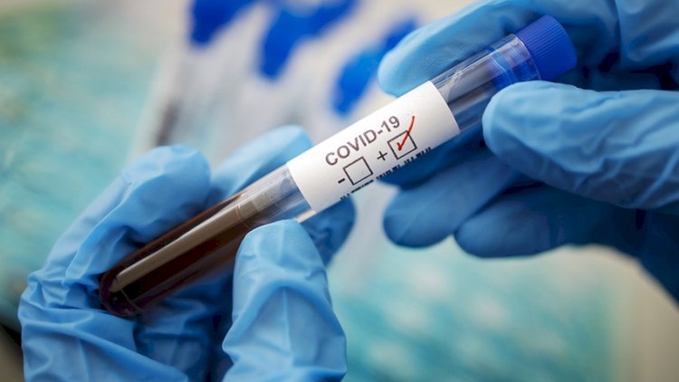    COVID-19 testi aparılarkən yol verilən nöqsanlar   